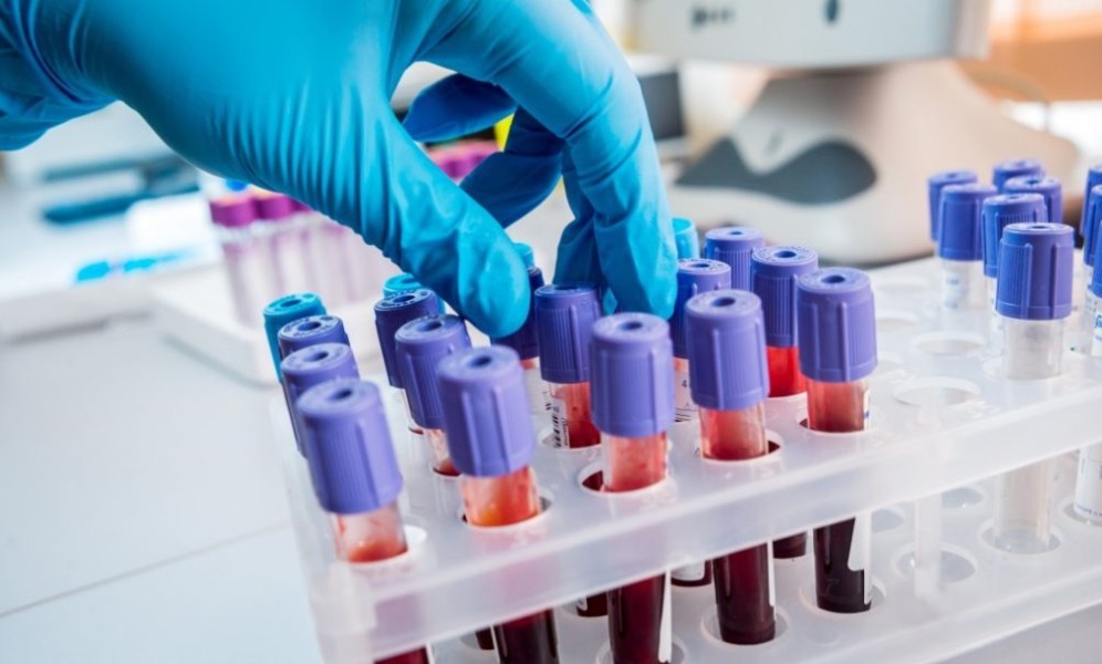 &laquo;Риск высок&raquo;: в мире заговорили о новой пандемии