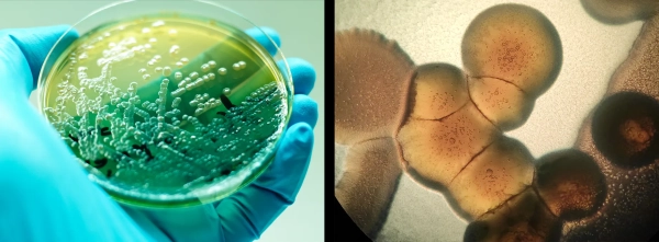 Бактериальный вид Pseudomonas aeruginosa, который образует биопленку в легких пациентов с муковисцидозом, показан двумя способами: слева он выглядит как полосы на чашке Петри, удерживаемой в руке в перчатке; справа он представлен на изображении с микроскопа, показывающем клетки крупным планом.