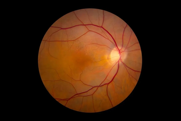 Имплант сетчатки восстанавливает зрение у слепых мышей 23 e70e0b0f21eaec0d7c734d3bfff30807.jpg