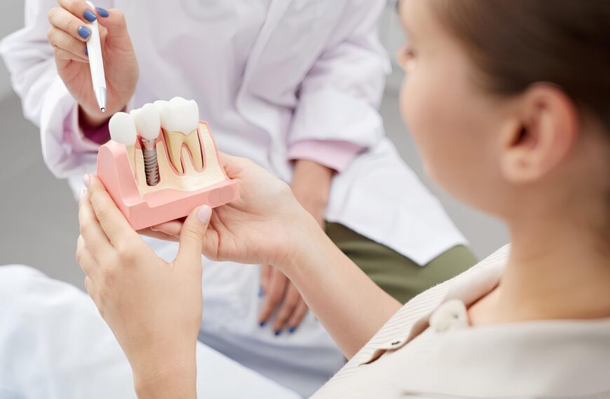 «Умные» импланты научились чувствовать: революция в стоматологии