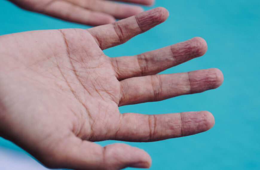 Почему после каждого купания пальцы&hellip;