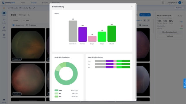 Тест производительности: модель LandingLens Vision улучшает классификацию ретинопатии 2 a2a6e3849a6087c5a7030278a7e49bb6
