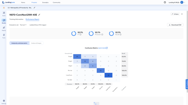 Тест производительности: модель LandingLens Vision улучшает классификацию ретинопатии 4 fe677239be974d0914c87fa650ee937c