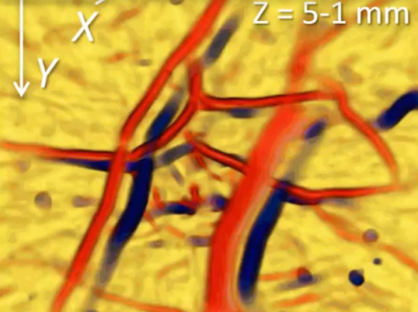 Ученые создали чувствительную антенну для наблюдения за кровотоком в мельчайших капиллярах