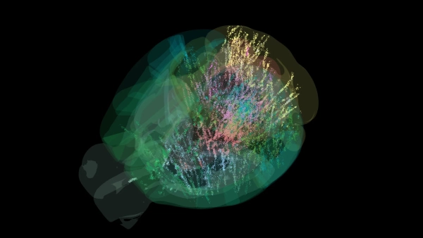 Ученые впервые увидели процесс принятия решений в мозге