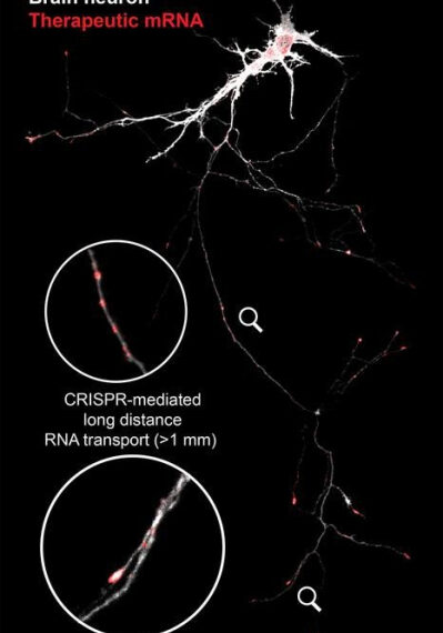 Новая технология поможет восстановить поврежденные нейроны