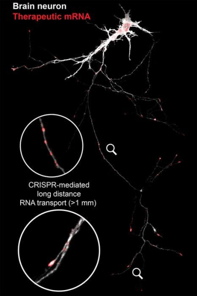 Новая технология поможет восстановить поврежденные нейроны 12 a27403b04a799918b99e458d939865ca.jpg
