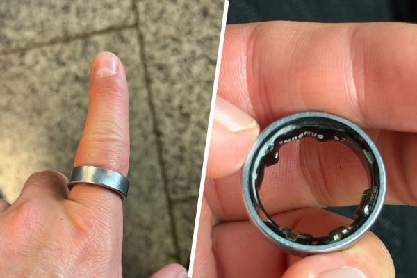 Раздувшийся аккумулятор умного кольца Galaxy Ring привел пользователя в больницу 2 fb6ced6cdf9579c22bfb8f28f55bd0b4.jpg