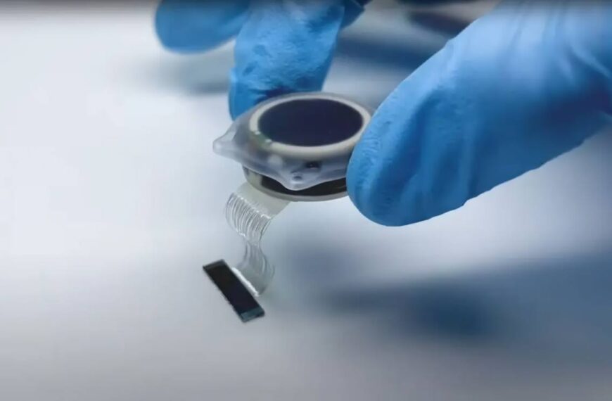 Neuralink в деле. В октябре&hellip;