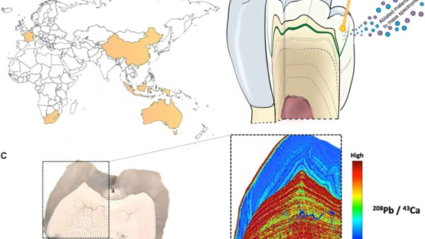 Хроническое отравление свинцом направило эволюцию мозга предков человека 