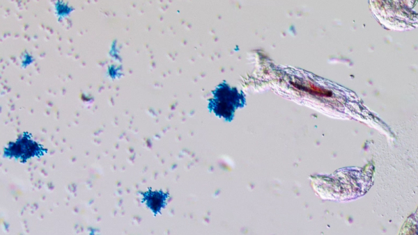 Микровидео коловраток, поедающих дрожжи.