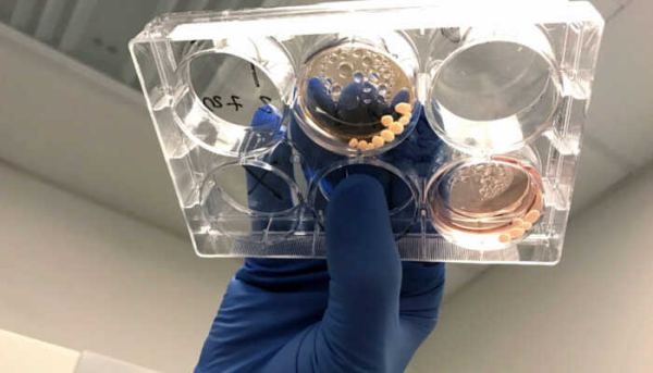 На эволюцию мозга древних людей повлиял свинец