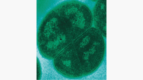 3b6248e998ba64a199fa005d2c4c2b27