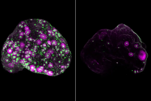 Скрытая экосистема яичников играет удивительную роль в фертильности 3 Яйца (зеленые) и часть растущих яйцеклеток (пурпурные) в яичнике мыши в возрасте двух месяцев (слева) и 12 месяцев (справа)