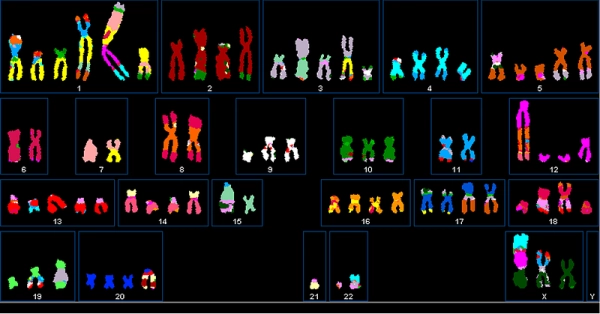 Как классифицировать подтип рака легких по количеству копий ДНК с помощью PyTorch 3 4f5a815fffefcd7ecae390257688c5ae