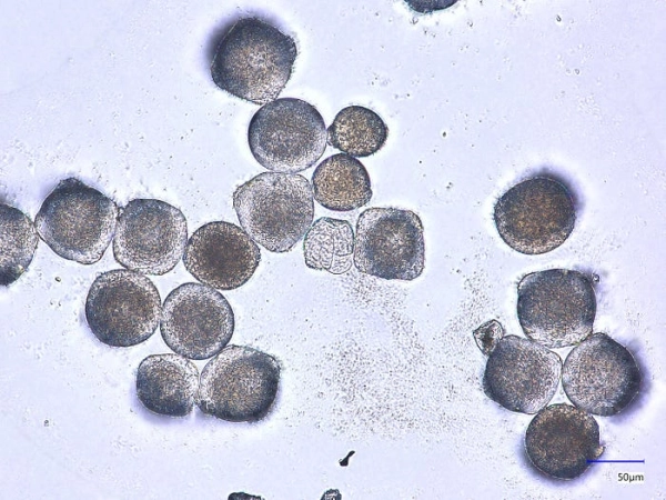 Визуальная классификация пыльцы с использованием сверточных нейронных сетей и Vision Transformers 3 5073c84273892f47694ec83f5df97836