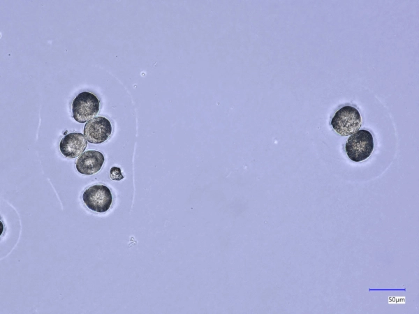 Визуальная классификация пыльцы с использованием сверточных нейронных сетей и Vision Transformers 5 68c8ee5e1c84357f0e1bb9bbf5ba4efc