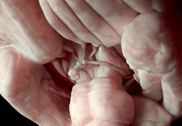 Крупный план головного мозга человека