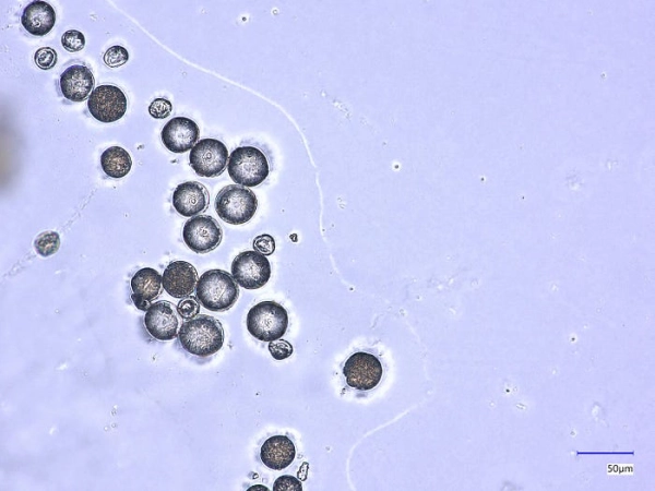 Визуальная классификация пыльцы с использованием сверточных нейронных сетей и Vision Transformers 2 81dc93eee0ac32069edbcbe4d0a41d65