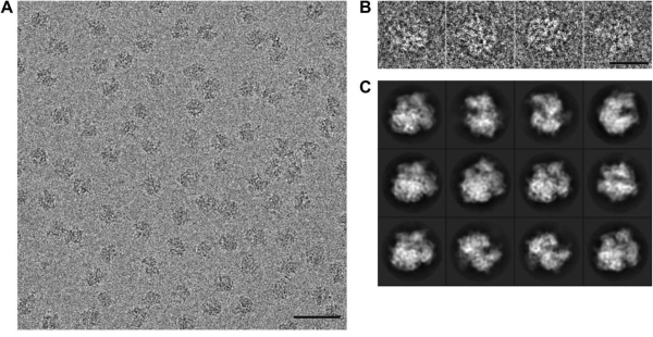 История электронного микроскопа 21 Микрофотографии рибосомы 70S (https://elifesciences.org/articles/00461#fig2s1)