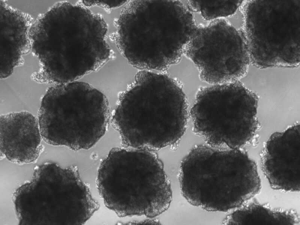 На эволюцию мозга древних людей повлиял свинец 2 af2799bd2f2636e36dc44489e08e6440