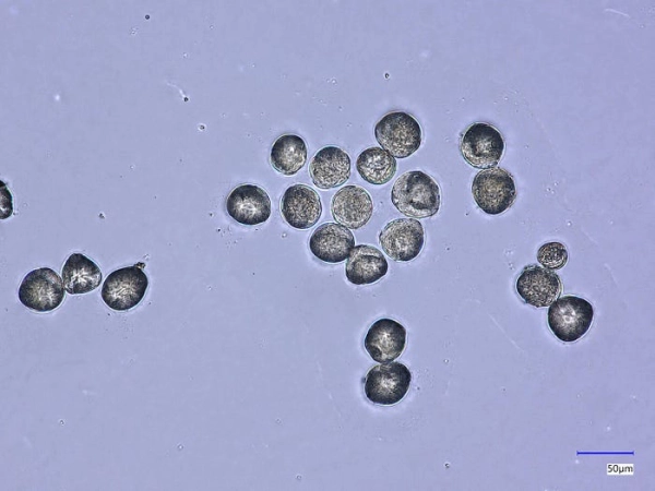 Визуальная классификация пыльцы с использованием сверточных нейронных сетей и Vision Transformers 4 b44148d99eedf7f48f23742e3ea8a0d1