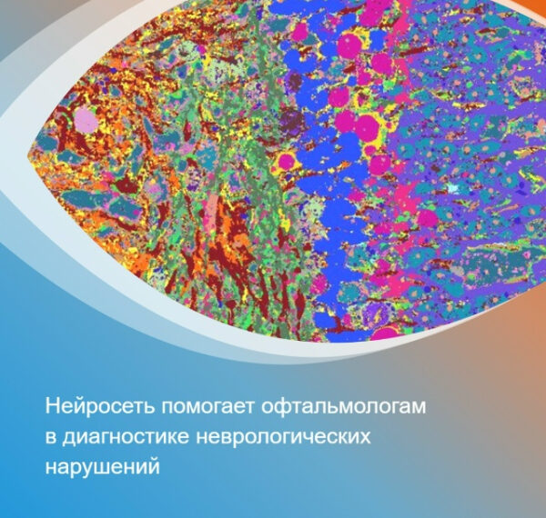 Снимки сетчатки глаза помогут выявлять&hellip;