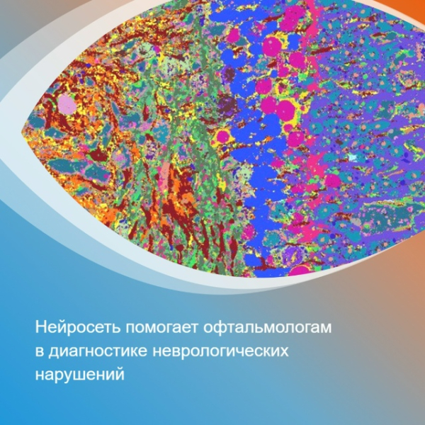 Снимки сетчатки глаза помогут выявлять неврологические расстройства: нейросеть в помощь офтальмологу 1 d14459ed4ed2eab99440f88a90a4a62c.jpg