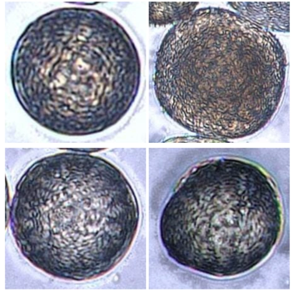 Визуальная классификация пыльцы с использованием сверточных нейронных сетей и Vision Transformers 22 dc25bc6dc81d5c1acfe19d36ae8d1844