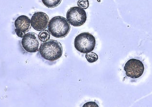 Визуальная классификация пыльцы с использованием сверточных нейронных сетей и Vision Transformers 4 de307c096bb721d32d0e9a439123b74f.jpg