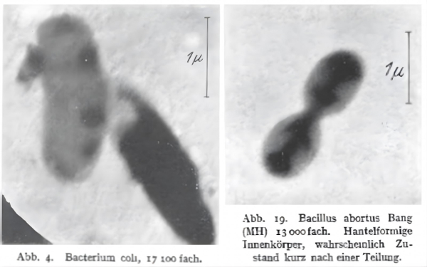 История электронного микроскопа 4 Электронные микрофотографии вируса эктромелии мыши, сделанные в 1938 году Эрнстом Руской, Хельмутом Руской и Бодо фон Борисом (https://link.springer.com/article/10.1007/BF01775798)