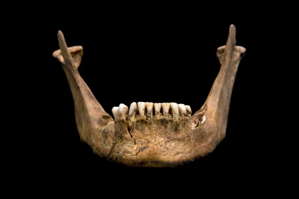 Челюсть и зубы короля Ричарда III