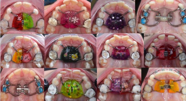 Как мы проектируем и ставим&hellip;