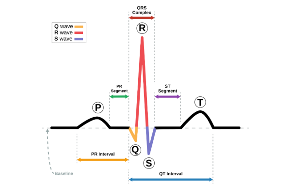 Нормальная картина сердечных сокращений, без аномалий Нормальная картина сердечных сокращений, без аномалий