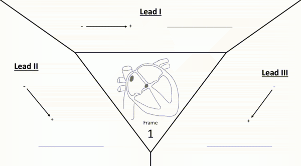Инженер, который научил компьютер слушать сердце: история Хейвуда и его кардиомонитора 2 32bf1f634d4d517d6198caea41890ab2