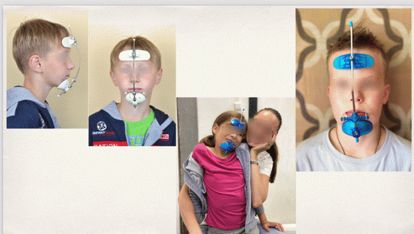 Так выглядит аппарат Хааса