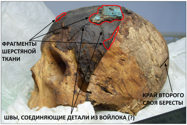 Цифровой рентген: перемываем кости, зубы,&hellip;