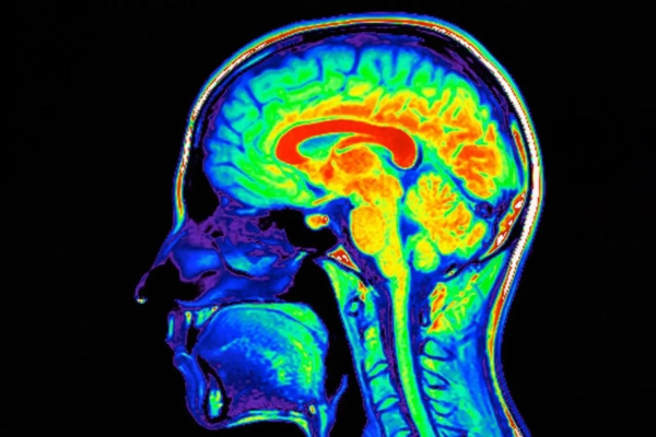 51722d2c798783be94e7899fa03b7e61