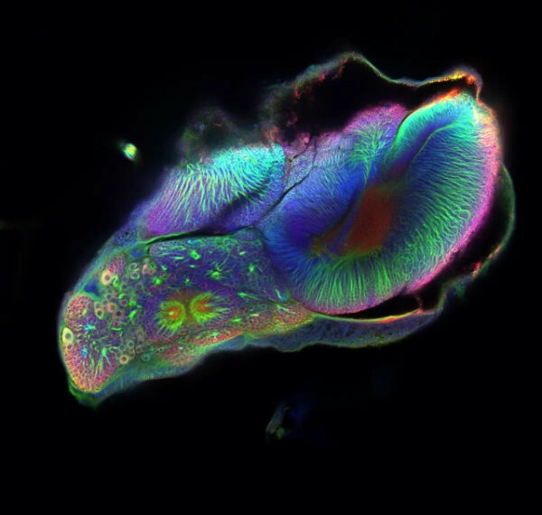 Мозг куколки, превращающейся в бабочку&hellip;