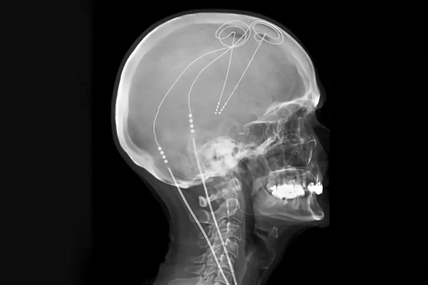 Ваш мозг переживает четыре драматических периода изменений в возрасте от 0 до 90 лет 4 7fcb569365f2b2b87ec19eb0ab88b124