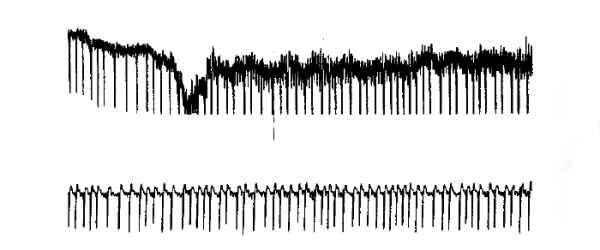 Сигнал до фильтрации и после Сигнал до фильтрации и после