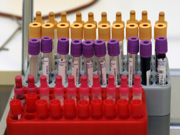 Анализ крови с помощью булавочного&hellip;