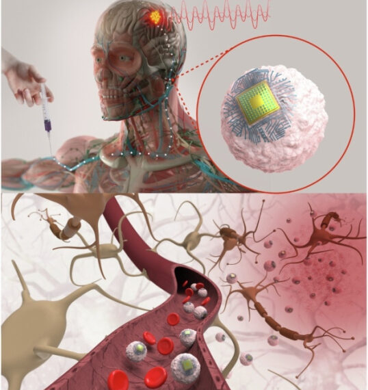 Операция на мозге через простую&hellip;