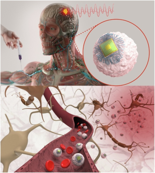 Операция на мозге через простую инъекцию 7 b3a57b335f3ea06af3eb8a4597d51879.jpg