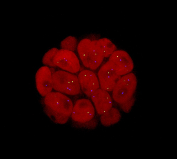 Раковые клетки крадут митохондрии у&hellip;