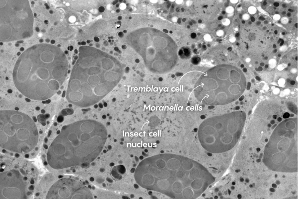 Микрофотография клетки мучнистого червеца с эндосимбионтами внутри.