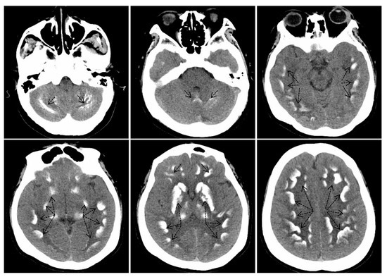 БОЛЕЗНЬ И СИНДРОМ ФАРА: РАЗЛИЧИЯ&hellip;