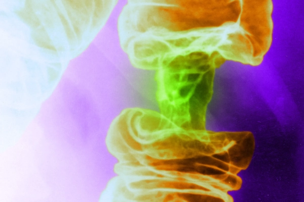 Новый метод лечения рака с&hellip;