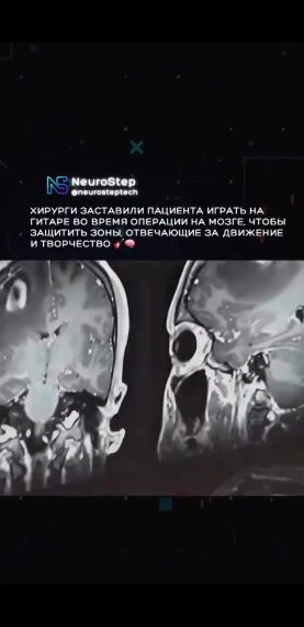 Чтобы операция не забрала у&hellip;