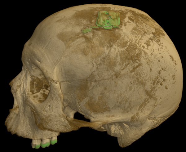 Микротомография черепа